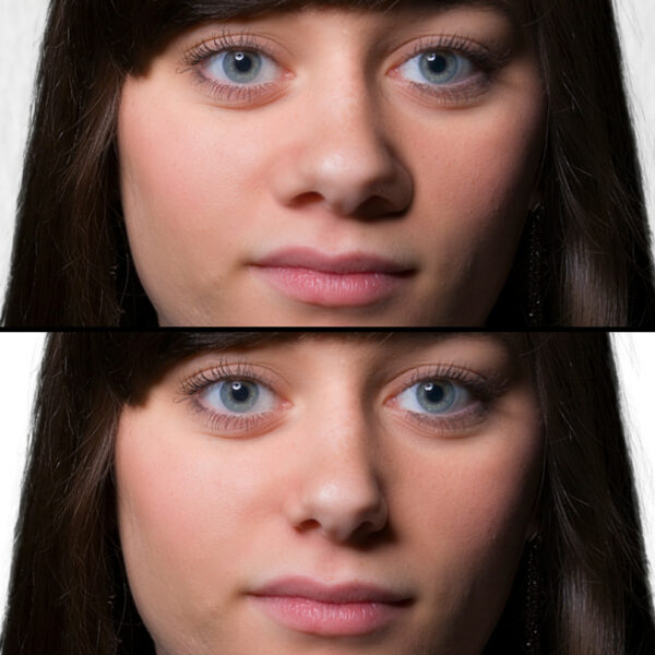 nostril narrowing