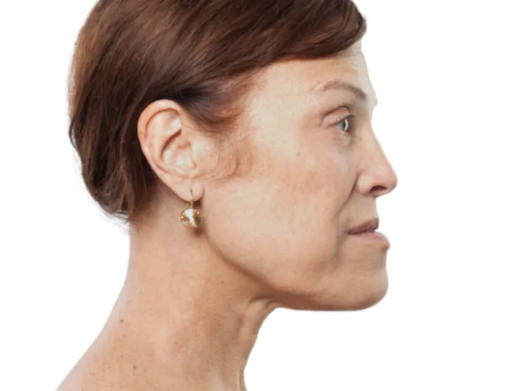 woman with chin forward