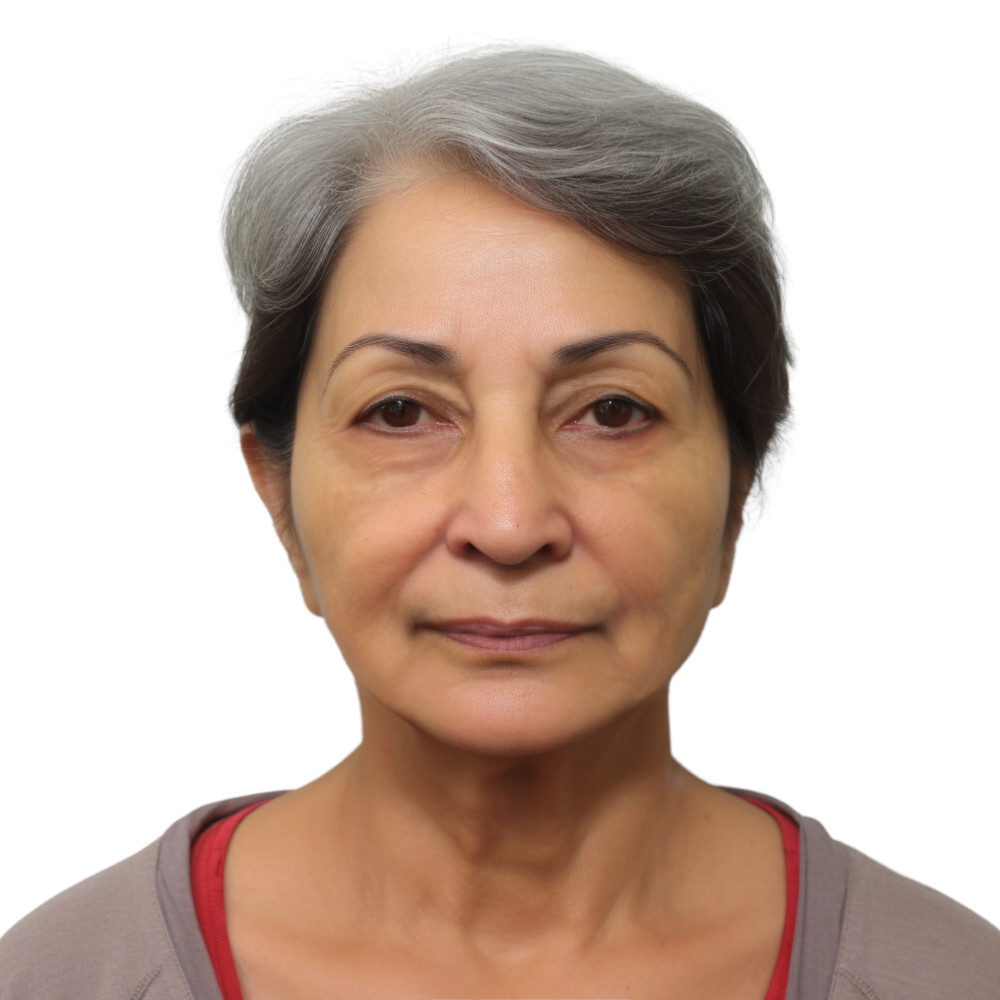 cosmetic surgery facelift blepharoplasty AFTER