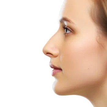 classical nose