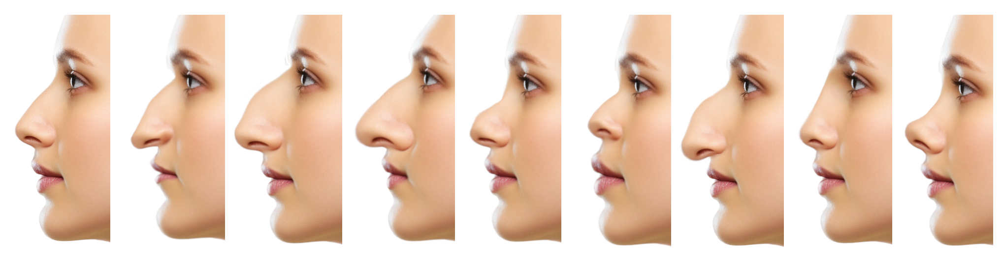 different nose shapes
