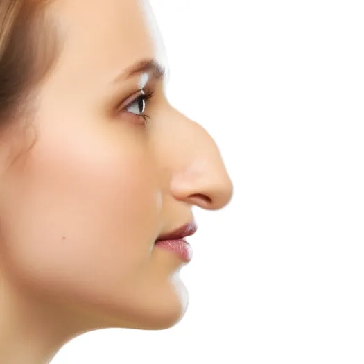 drooping nose