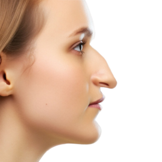 woman with a hooked nose