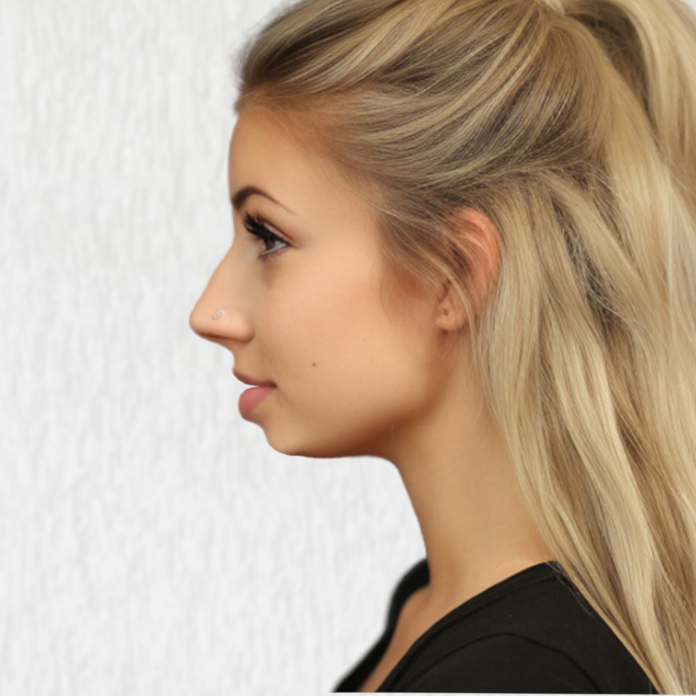 recessed jaw