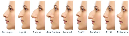 9 types of noses