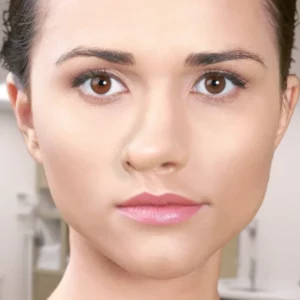 crooked nose rhinoplasty (21)