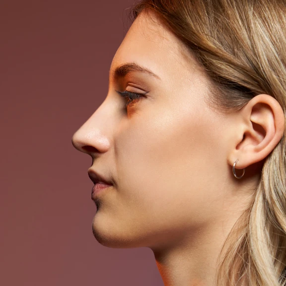 greek nose rhinoplasty