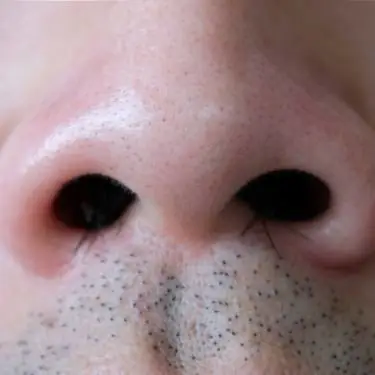nose hair