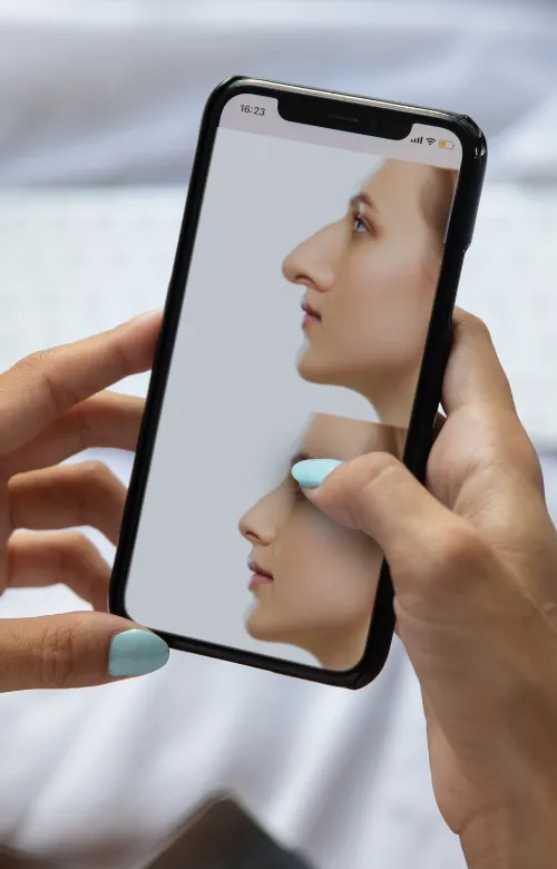 rhinoplasty simulator app AI 3D