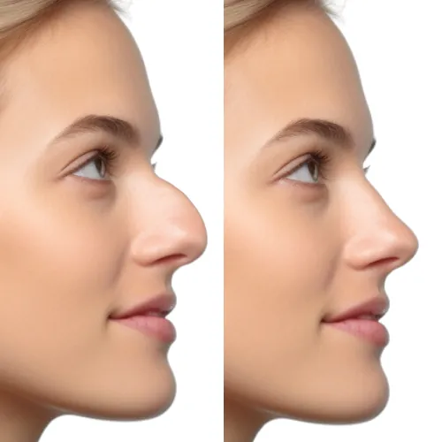 surgery before after