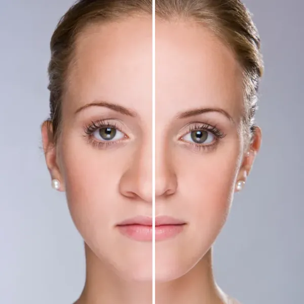 big nose before after front view