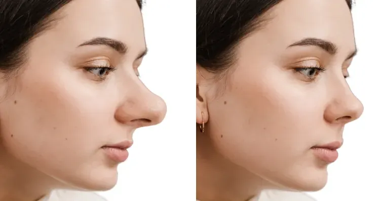 big nose