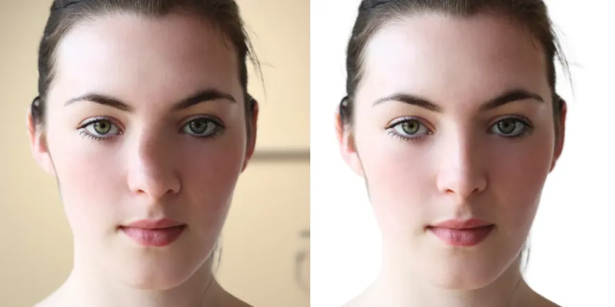 crooked nose before after