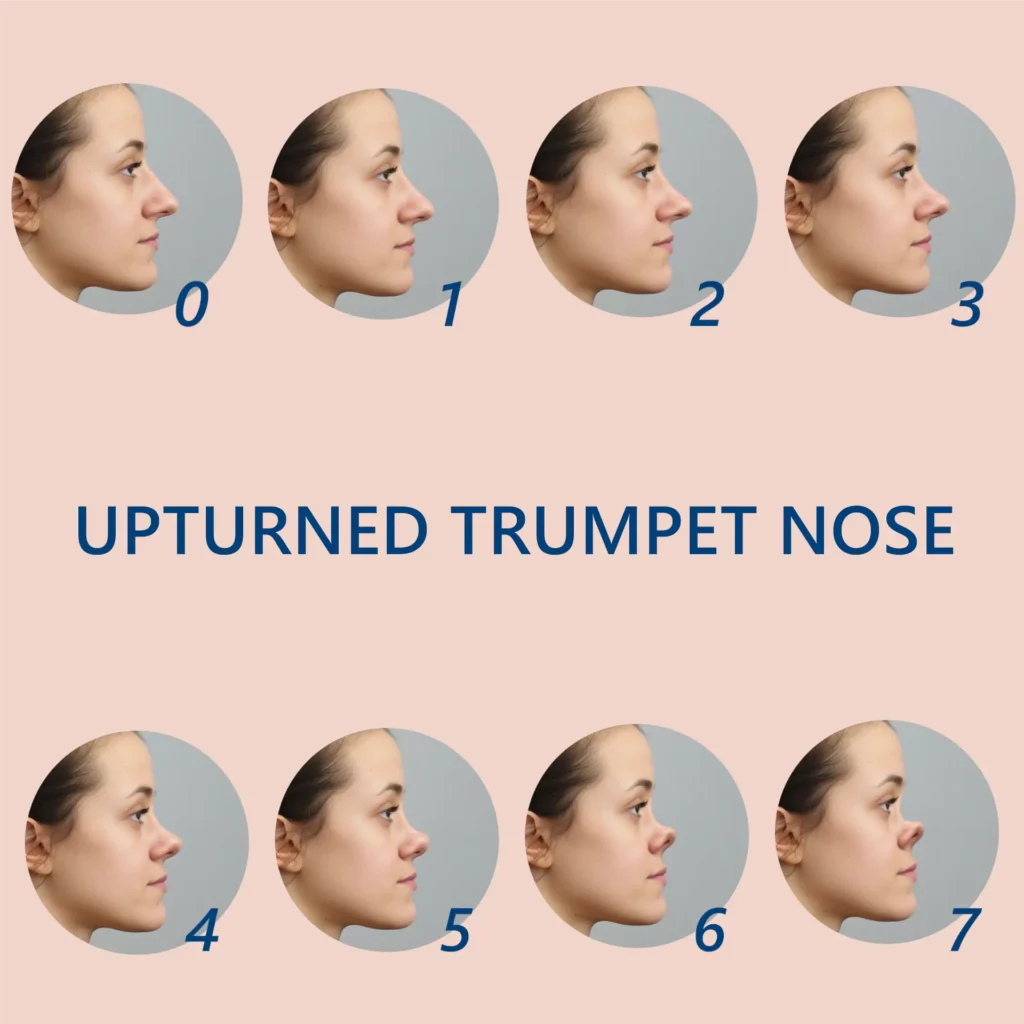 upturned trumpet nose