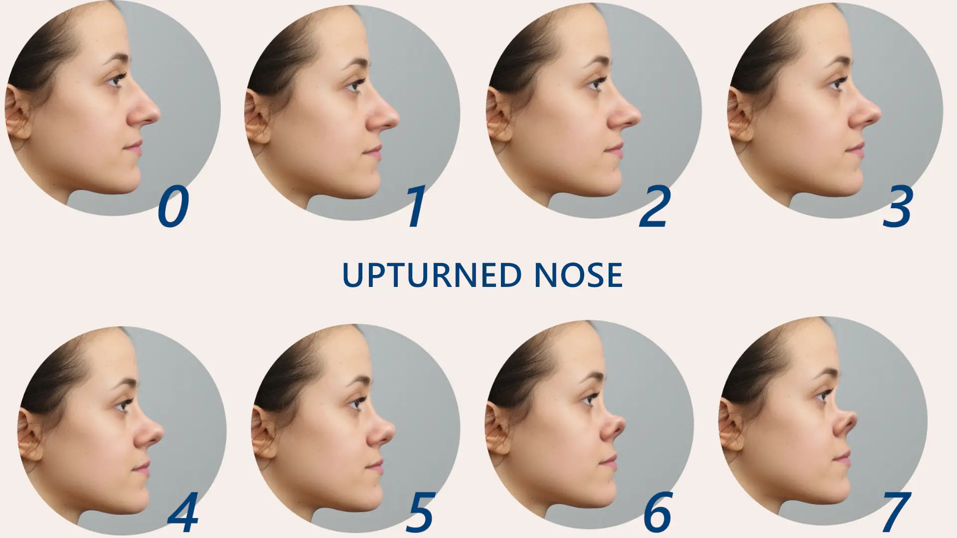 upturned trumpet nose (150)