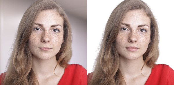 lips surgery